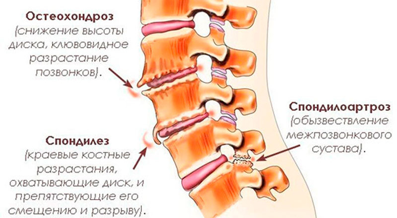 болит шея сзади / почему болит шея сзади